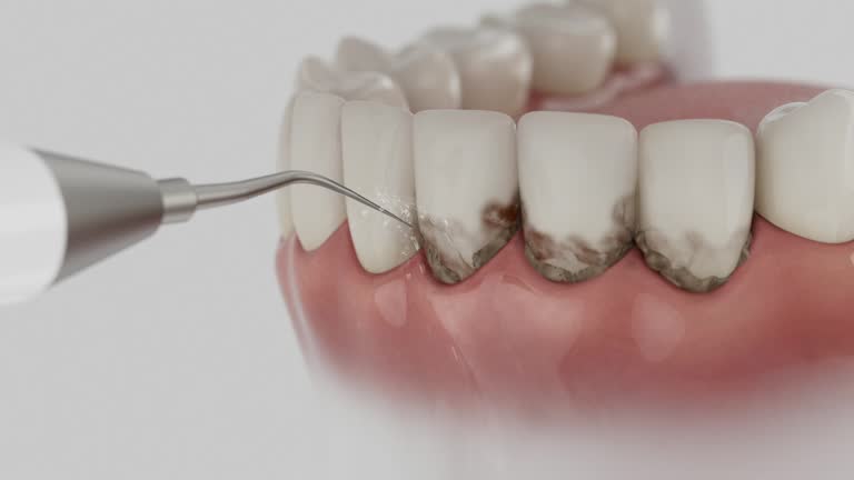 Reliable Teeth Cleaning And Checkup contractor in Louisa County County, IA by Dentist Open Now
